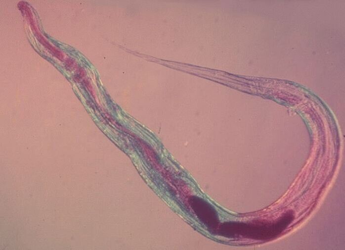 Roundworm under the microscope