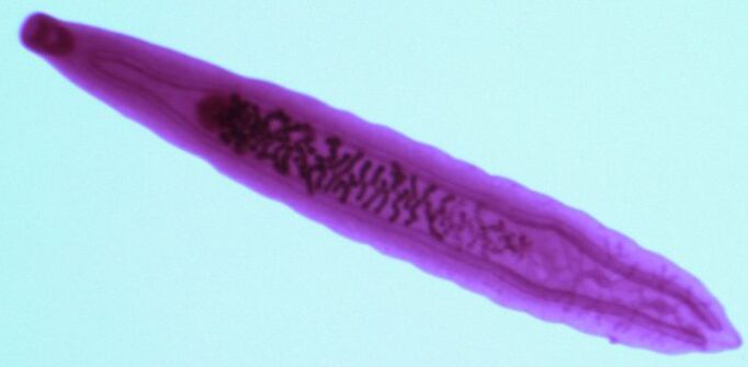 trematode parasite of the human body